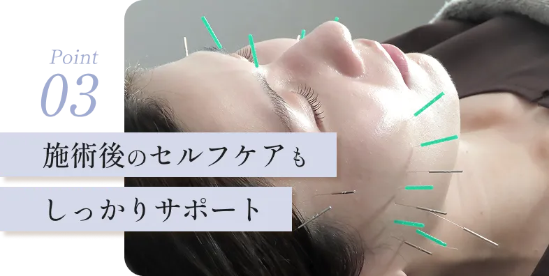 施術後のセルフケアもしっかりサポート